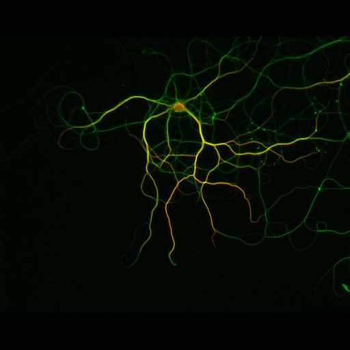  NCBI Organism:Rattus; Cell Types:multipolar neuron Cell Components:dendrite, microtubule cytoskeleton, axon, synaptic vesicle; Biological process:cellular developmental process, dendrite development, establishment or maintenance of cell polarity, establishment or maintenance of microtubule cytoskeleton polarity;