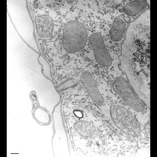  NCBI Organism:Tetrahymena pyriformis; Cell Types:cell by organism, eukaryotic cell, , ; Cell Components:peroxisome, endoplasmic reticulum, plasma membrane, ; Biological process:cytoplasm organization