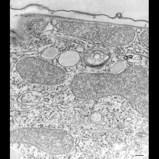  NCBI Organism:Tetrahymena pyriformis; Cell Types:cell by organism, eukaryotic cell, , ; Cell Components:early endosome, cortical microtubule cytoskeleton, microtubule basal body, pellicle, mitochondrial inner membrane; Biological process:mitochondrion organization, endosome organization;