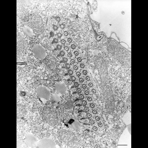  NCBI Organism:Tetrahymena pyriformis; Cell Types:cell by organism, eukaryotic cell, , ; Cell Components:microtubule basal body, oral apparatus, endosome, microtubule associated complex; Biological process:oral apparatus organization