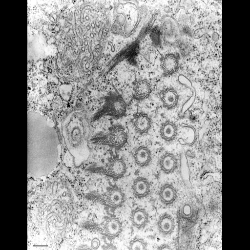  NCBI Organism:Tetrahymena pyriformis; Cell Types:cell by organism, eukaryotic cell, , ; Cell Components:oral apparatus Biological process:oral apparatus organization