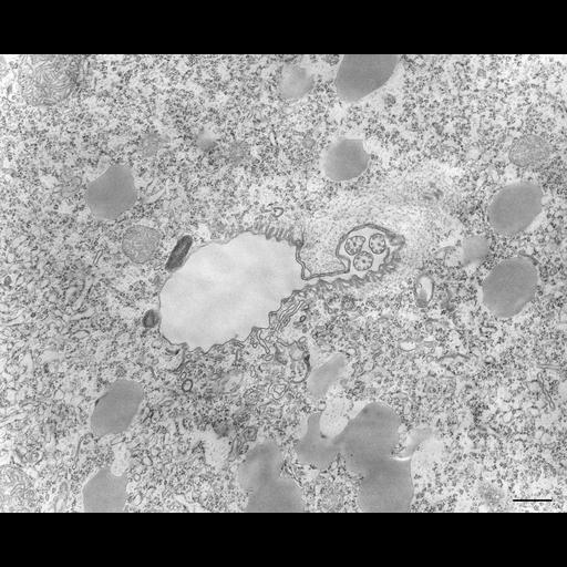  NCBI Organism:Tetrahymena pyriformis; Cell Types:cell by organism, eukaryotic cell, , ; Cell Components:oral apparatus, primary lysosome, , microtubule associated complex, ; Biological process:oral apparatus organization