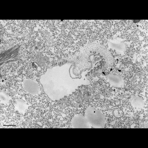  NCBI Organism:Tetrahymena pyriformis; Cell Types:cell by organism, eukaryotic cell, , ; Cell Components:, plasma membrane, microtubule associated complex, vesicle membrane; Biological process:oral apparatus organization