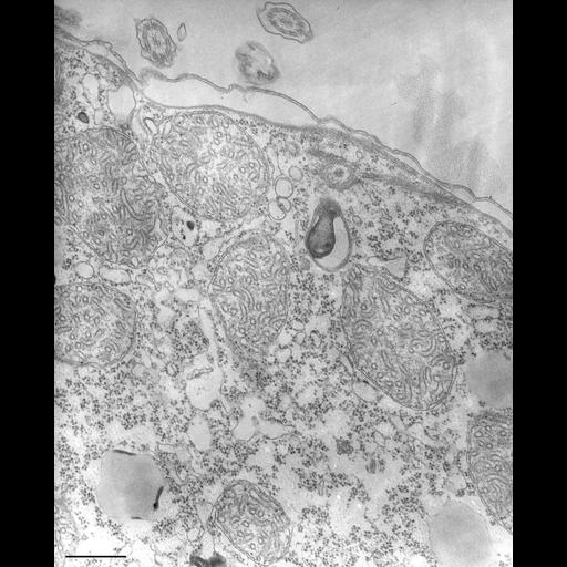  NCBI Organism:Tetrahymena pyriformis; Cell Types:cell by organism, eukaryotic cell, , ; Cell Components:, organelle membrane; Biological process:digestive system process