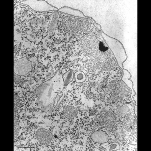  NCBI Organism:Tetrahymena pyriformis; Cell Types:cell by organism, eukaryotic cell, , ; Cell Components:lysosome, , cytoplasm, cell cortex; Biological process:cytoplasm organization