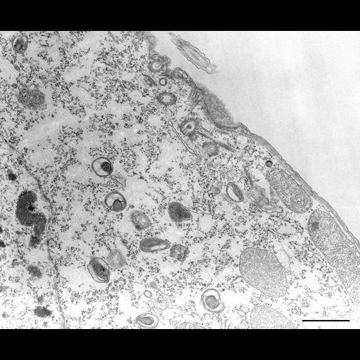  NCBI Organism:Tetrahymena pyriformis; Cell Types:cell by organism, eukaryotic cell, , ; Cell Components:phagocytic vesicle, sodium ion-transporting V-type ATPase complex; Biological process:phagocytosis