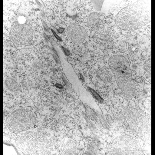  NCBI Organism:Tetrahymena pyriformis; Cell Types:cell by organism, eukaryotic cell, , ; Cell Components:cytostome, , ; Biological process:digestive system process