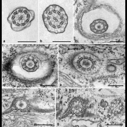  NCBI Organism:Tetrahymena pyriformis; Cell Types:cell by organism, eukaryotic cell, , ; Cell Components:microtubule basal body, cilium, cortical cytoskeleton, cortical microtubule, transverse to long axis; Biological process:microtubule basal body organization, cortical cytoskeleton organization;