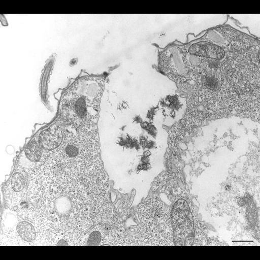  NCBI Organism:Tetrahymena pyriformis; Cell Types:cell by organism, eukaryotic cell, , ; Cell Components:cytoproct, plasma membrane, cell cortex; Biological process:defecation