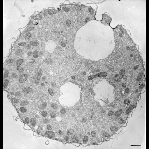  NCBI Organism:Tetrahymena pyriformis; Cell Types:cell by organism, eukaryotic cell, , ; Cell Components:contractile vacuole pore, contractile vacuole, cell cortex; Biological process:contractile vacuole organization