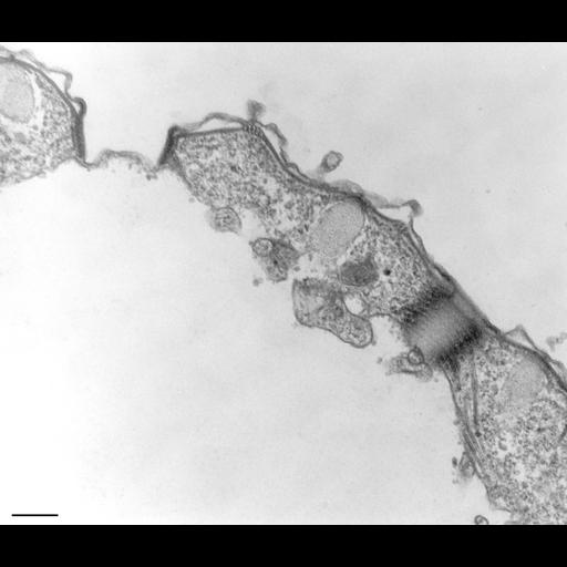  NCBI Organism:Tetrahymena pyriformis; Cell Types:cell by organism, eukaryotic cell, , ; Cell Components:contractile vacuole pore, contractile vacuole, microtubule associated complex, cell cortex; Biological process:contractile vacuole organization