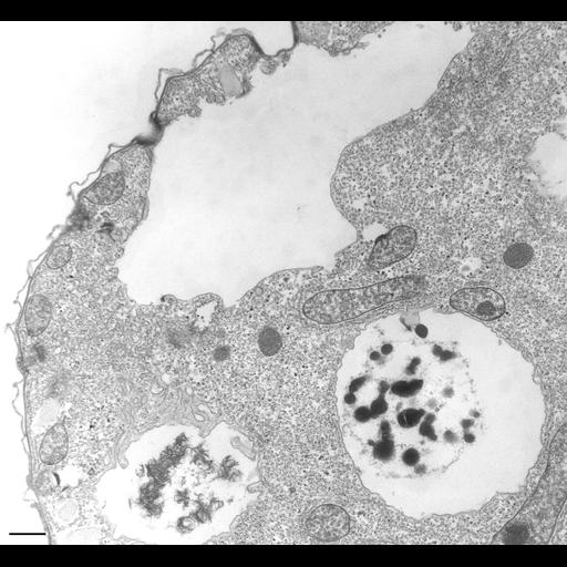  NCBI Organism:Tetrahymena pyriformis; Cell Types:cell by organism, eukaryotic cell, , ; Cell Components:contractile vacuole, contractile vacuole pore, contractile vacuolar membrane, intrinsic to contractile vacuolar membrane, proton-transporting V-type ATPase complex, food vacuole; Biological process:contractile vacuole organization