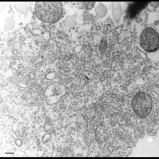  NCBI Organism:Tetrahymena pyriformis; Cell Types:cell by organism, eukaryotic cell, , ; Cell Components:contractile vacuole, contractile vacuolar membrane, intrinsic to contractile vacuolar membrane; Biological process:contractile vacuole organization