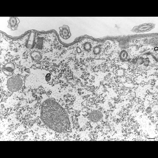  NCBI Organism:Tetrahymena pyriformis; Cell Types:cell by organism, eukaryotic cell, , ; Cell Components:microtubule basal body, microtubule associated complex; Biological process:microtubule basal body duplication