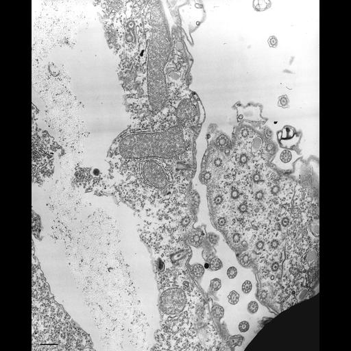  NCBI Organism:Tetrahymena pyriformis; Cell Types:cell by organism, eukaryotic cell, , ; Cell Components:oral apparatus, microtubule basal body, cell division site; Biological process:oral apparatus organization, , asymmetric cell division;