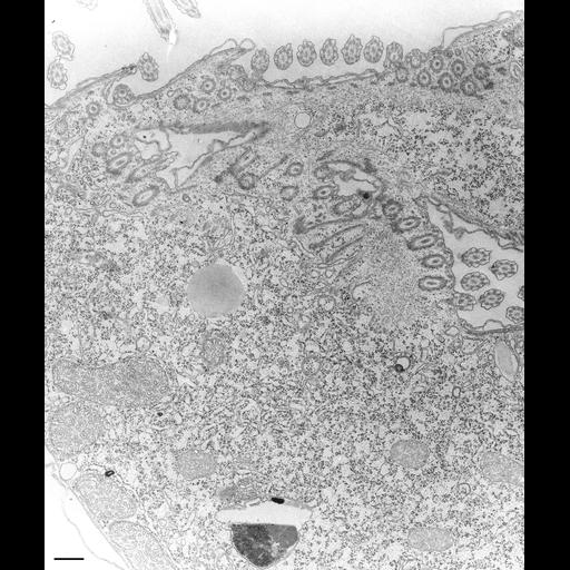  NCBI Organism:Tetrahymena pyriformis; Cell Types:cell by organism, eukaryotic cell, , ; Cell Components:microtubule basal body, oral apparatus; Biological process:oral apparatus organization, regulation of asymmetric cell division, microtubule basal body duplication;