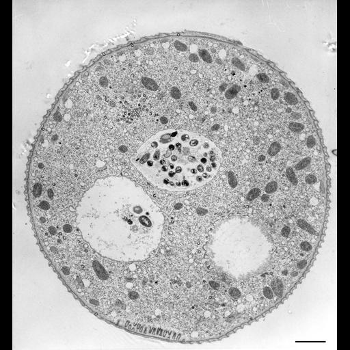  NCBI Organism:Vorticella convallaria; Cell Types:cell by organism, eukaryotic cell, , ; Cell Components:cell, food vacuole; Biological process:digestive system process, cytoplasm organization, cortical cytoskeleton organization;