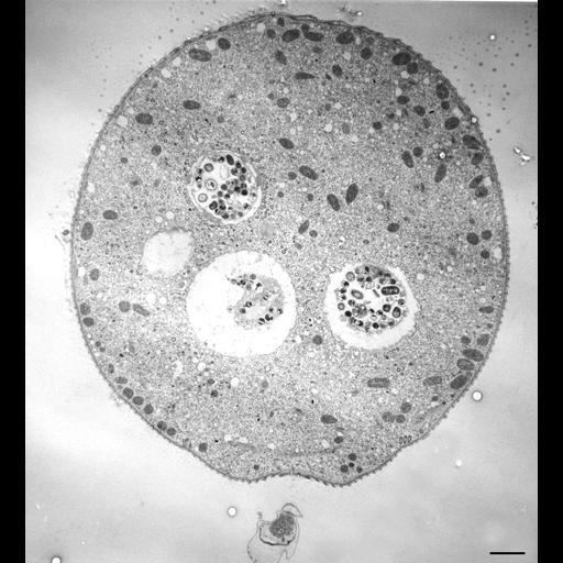  NCBI Organism:Vorticella convallaria; Cell Types:cell by organism, eukaryotic cell, , ; Cell Components:cell, food vacuole, , ; Biological process:digestive system process, cytoplasm organization, cortical cytoskeleton organization;