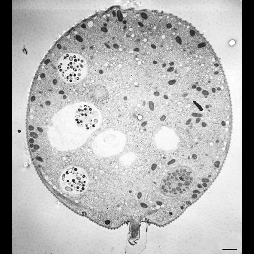 CIL:36247, Vorticella convallaria, cell by organism, eukaryotic cell ...