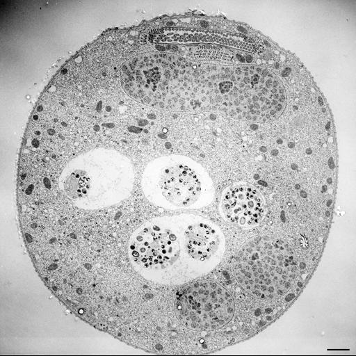  NCBI Organism:Vorticella convallaria; Cell Types:cell by organism, eukaryotic cell, , ; Cell Components:cell, food vacuole, macronucleus, oral apparatus, ; Biological process:digestive system process, cytoplasm organization, cortical cytoskeleton organization, macronucleus organization, oral apparatus organization, digestive system process;