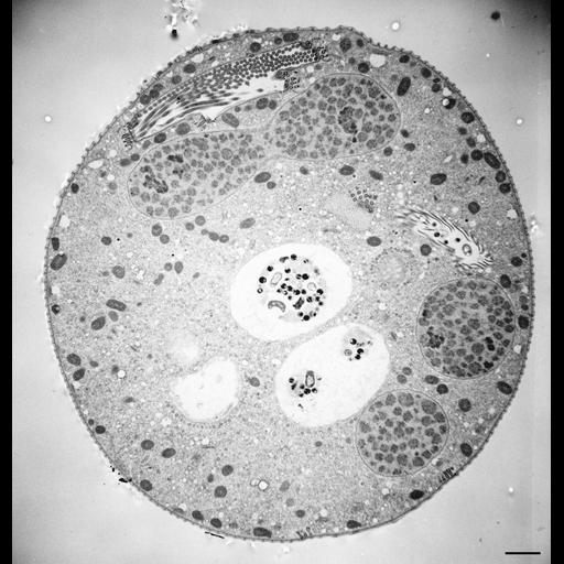  NCBI Organism:Vorticella convallaria; Cell Types:cell by organism, eukaryotic cell, , ; Cell Components:cell, food vacuole; Biological process:digestive system process, cytoplasm organization, cortical cytoskeleton organization;