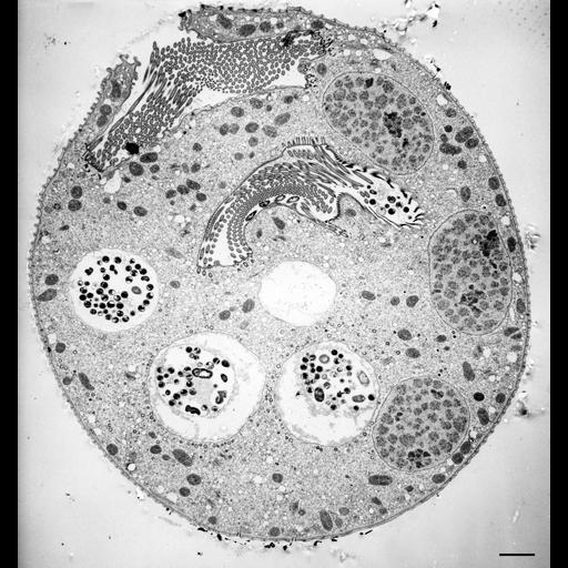  NCBI Organism:Vorticella convallaria; Cell Types:cell by organism, eukaryotic cell, , ; Cell Components:cell, food vacuole, macronucleus, oral apparatus, cytostome; Biological process:digestive system process, cytoplasm organization, cortical cytoskeleton organization, macronucleus organization, oral apparatus organization, digestive system process;