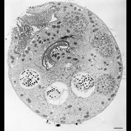  NCBI Organism:Vorticella convallaria; Cell Types:cell by organism, eukaryotic cell, , ; Cell Components:cell, food vacuole, macronucleus, oral apparatus; Biological process:digestive system process, cytoplasm organization, cortical cytoskeleton organization, macronucleus organization, oral apparatus organization;