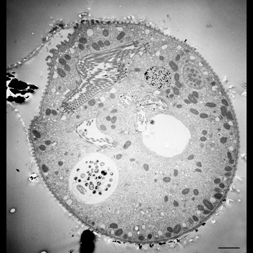  NCBI Organism:Vorticella convallaria; Cell Types:cell by organism, eukaryotic cell, , ; Cell Components:cell, food vacuole, macronucleus, micronucleus, contractile vacuole, contractile vacuole pore, oral apparatus; Biological process:digestive system process, cytoplasm organization, cortical cytoskeleton organization, macronucleus organization, micronucleus organization, contractile vacuole organization, oral apparatus organization;