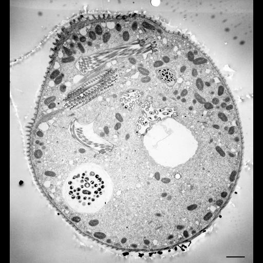  NCBI Organism:Vorticella convallaria; Cell Types:cell by organism, eukaryotic cell, , ; Cell Components:cell, food vacuole, micronucleus, contractile vacuole, contractile vacuole pore, oral apparatus, food vacuole; Biological process:digestive system process, cytoplasm organization, cortical cytoskeleton organization, micronucleus organization, contractile vacuole organization, oral apparatus organization, digestive system process;