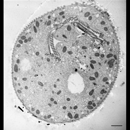  NCBI Organism:Vorticella convallaria; Cell Types:cell by organism, eukaryotic cell, , ; Cell Components:cell, food vacuole, contractile vacuole, oral apparatus; Biological process:digestive system process, cytoplasm organization, cortical cytoskeleton organization, oral apparatus organization, contractile vacuole organization;