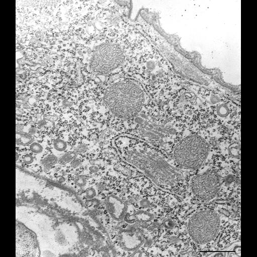  NCBI Organism:Vorticella convallaria; Cell Types:cell by organism, eukaryotic cell, , ; Cell Components:rough endoplasmic reticulum, lysosome, Golgi apparatus, cytoplasm, ; Biological process:Golgi organization, cytoplasm organization;