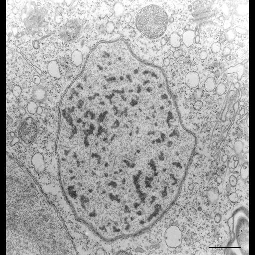  NCBI Organism:Vorticella convallaria; Cell Types:cell by organism, eukaryotic cell, , ; Cell Components:micronucleus, macronucleus, nuclear pore, heterochromatin; Biological process:micronucleus organization, macronucleus organization;