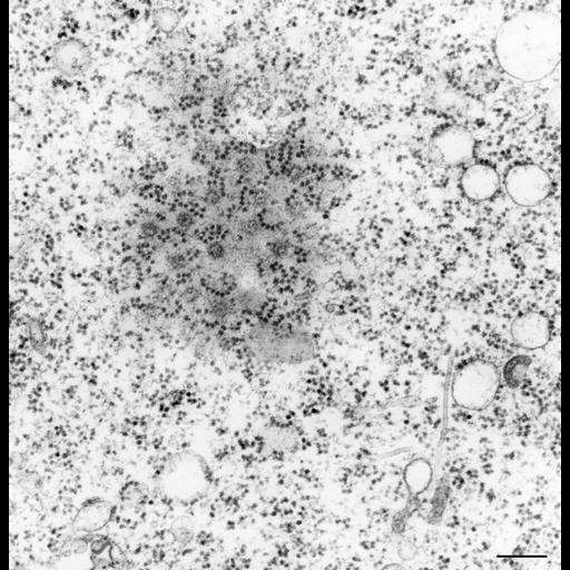  NCBI Organism:Vorticella convallaria; Cell Types:cell by organism, eukaryotic cell, , ; Cell Components:nuclear envelope, polysome, nuclear pore; Biological process:nucleus organization, ;