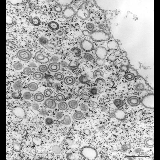  NCBI Organism:Vorticella convallaria; Cell Types:cell by organism, eukaryotic cell, , ; Cell Components:Golgi transport complex, food vacuole; Biological process:post-Golgi vesicle-mediated transport, Golgi to vacuole transport;