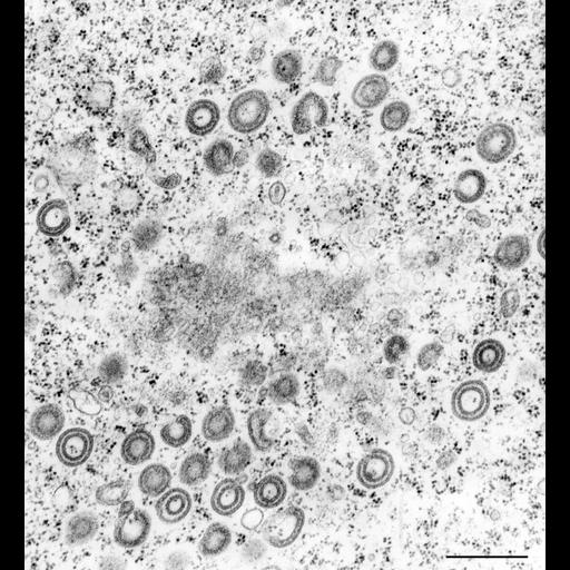  NCBI Organism:Vorticella convallaria; Cell Types:cell by organism, eukaryotic cell, , ; Cell Components:Golgi-associated vesicle membrane, food vacuole; Biological process:Golgi to vacuole transport