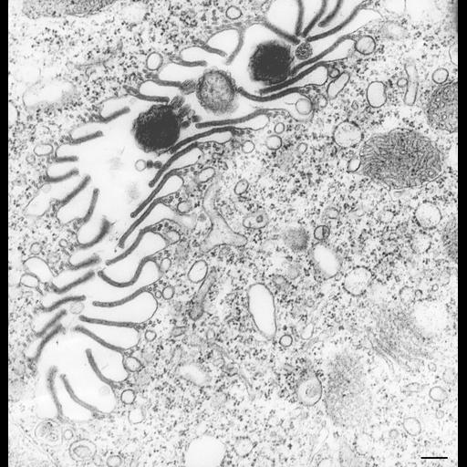  NCBI Organism:Vorticella convallaria; Cell Types:cell by organism, eukaryotic cell, , ; Cell Components:oral apparatus, microtubule associated complex, plasma membrane; Biological process:oral apparatus organization