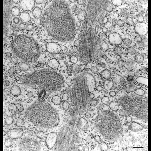  NCBI Organism:Vorticella convallaria; Cell Types:cell by organism, eukaryotic cell, , ; Cell Components:cytoplasm, endoplasmic reticulum, mitochondrion, mitochondrial inner membrane; Biological process:endoplasmic reticulum organization, mitochondrion organization;