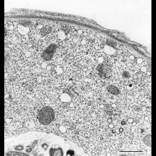  NCBI Organism:Vorticella convallaria; Cell Types:cell by organism, eukaryotic cell, , ; Cell Components:pellicle, rough endoplasmic reticulum, fibril; Biological process:cortical cytoskeleton organization, endoplasmic reticulum organization;