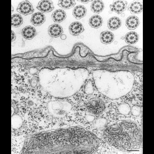  NCBI Organism:Vorticella convallaria; Cell Types:cell by organism, eukaryotic cell, , ; Cell Components:pellicle, endoplasmic reticulum, cell cortex, cilium; Biological process:cortical cytoskeleton organization, endoplasmic reticulum organization, cilium movement;