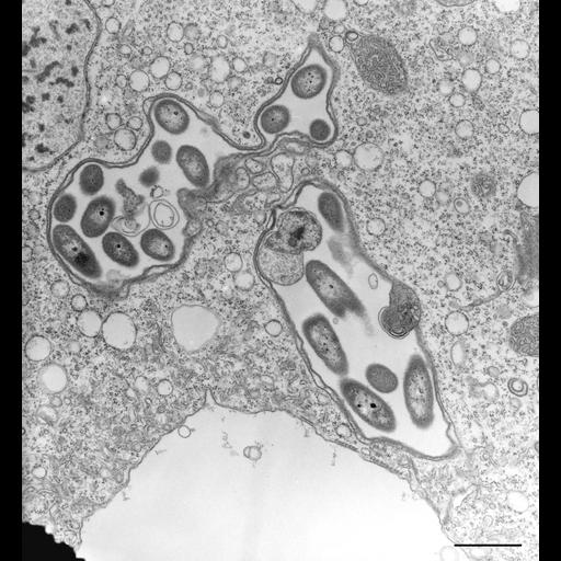  NCBI Organism:Vorticella convallaria; Cell Types:cell by organism, eukaryotic cell, , ; Cell Components:contractile vacuole, , microtubule associated complex; Biological process:contractile vacuole organization, microtubule-based process, macronucleus organization;