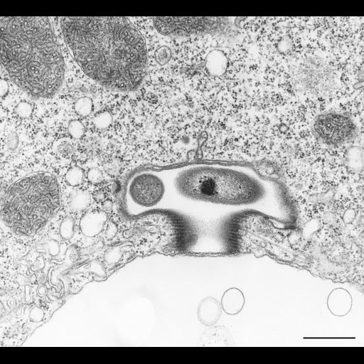  NCBI Organism:Vorticella convallaria; Cell Types:cell by organism, eukaryotic cell, , ; Cell Components:contractile vacuole, plasma membrane, contractile vacuolar membrane, contractile vacuole pore, microtubule associated complex, symbiont-containing vacuolar space; Biological process:contractile vacuole organization, plasma membrane organization, microtubule-based process, detection of symbiont;