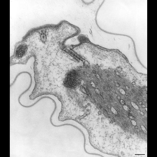  NCBI Organism:Vorticella convallaria; Cell Types:cell by organism, eukaryotic cell, , ; Cell Components:microtubule basal body, myofibril, ; Biological process:microtubule basal body organization, regulation of muscle contraction;