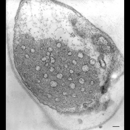  NCBI Organism:Vorticella convallaria; Cell Types:cell by organism, eukaryotic cell, , ; Cell Components:endoplasmic reticulum, myofibril, ; Biological process:, muscle system process;