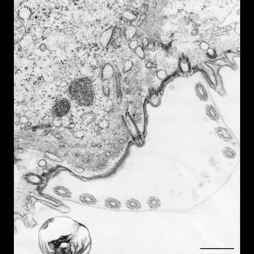  NCBI Organism:Vorticella convallaria; Cell Types:cell by organism, eukaryotic cell, , ; Cell Components:microtubule basal body, ; Biological process:microtubule basal body organization, ;