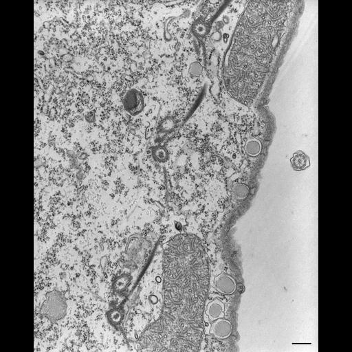  NCBI Organism:Tetrahymena pyriformis; Cell Types:cell by organism, eukaryotic cell, , ; Cell Components:microtubule basal body, microtubule associated complex, fibril; Biological process:microtubule basal body duplication