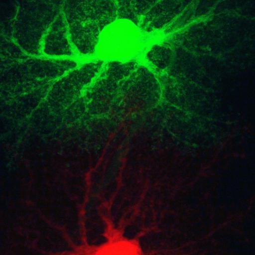  NCBI Organism:Rattus; Cell Types:astrocyte Cell Components:cell projection cytoplasm, cell body; Biological process:forebrain astrocyte development