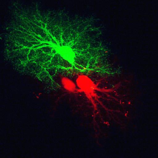  NCBI Organism:Rattus; Cell Types:astrocyte Cell Components:cell projection cytoplasm, cell body; Biological process:forebrain astrocyte development