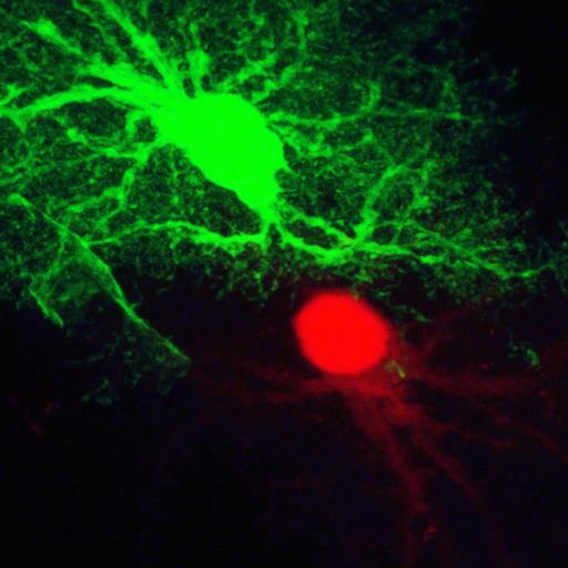  NCBI Organism:Rattus; Cell Types:astrocyte Cell Components:cell projection cytoplasm, cell body; Biological process:forebrain astrocyte development