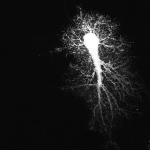  NCBI Organism:Rattus; Cell Types:astrocyte Cell Components:cell projection cytoplasm, cell body; Biological process:forebrain astrocyte development