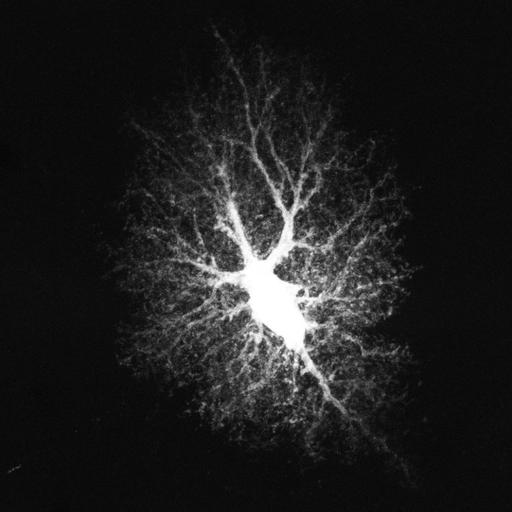  NCBI Organism:Rattus; Cell Types:astrocyte Cell Components:cell projection cytoplasm, cell body; Biological process:forebrain astrocyte development